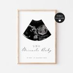 Tablou Ecograf Personalizabil "Little Miracle", Little Amy