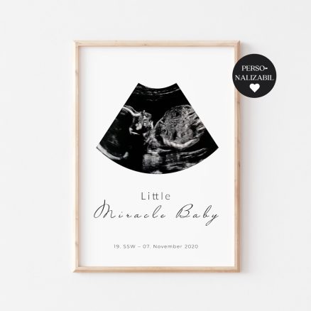 Tablou Ecograf Personalizabil "Little Miracle", Little Amy