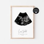 Tablou Ecograf Personalizabil cu numele bebelușului, Little Amy